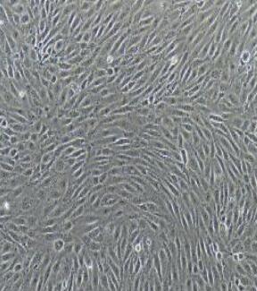 淋巴管内皮细胞