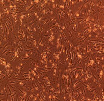 牙周膜成纤维细胞