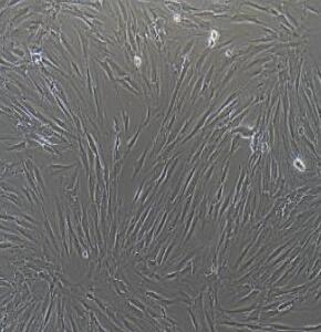 人牙龈成纤维细胞