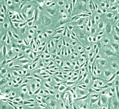 人脉络膜微血管内皮细胞