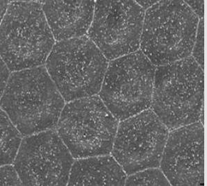 人角膜内皮细胞