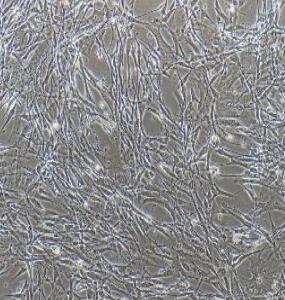 人胎盘微血管内皮细胞