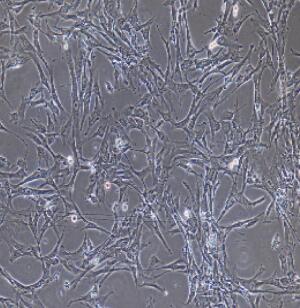 人胎盘绒毛膜滋养层细胞