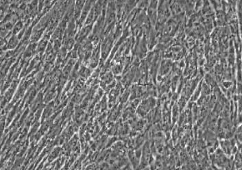 人脐静脉平滑肌细胞