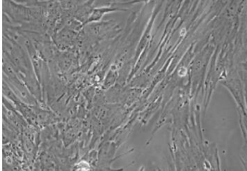 人脐动脉平滑肌细胞