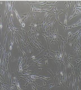 人脐带间充质干细胞