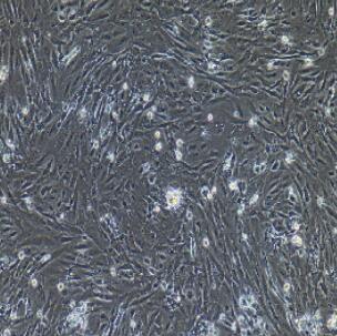 人小肠成纤维细胞