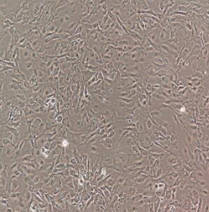 人肝窦内皮细胞