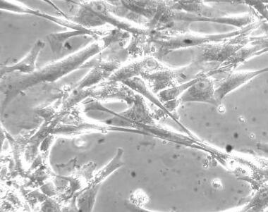 人胆囊动脉内皮细胞