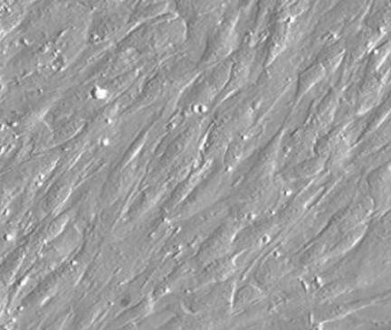 人脾成纤维细胞