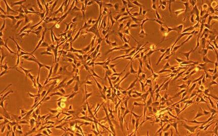 人冠状动脉平滑肌细胞