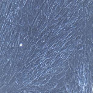 大鼠肺大动脉外膜成纤维细胞