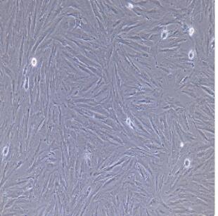 大鼠主动脉外膜成纤维细胞