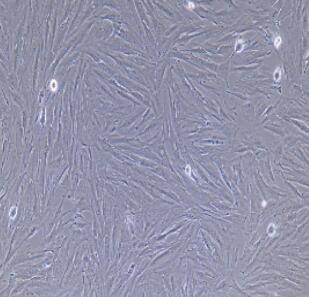 大鼠腹腔主动脉外膜成纤维细胞