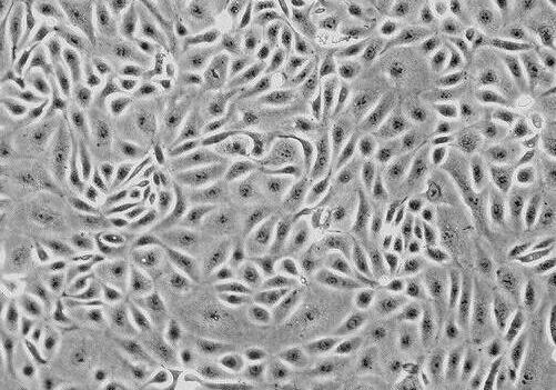 大鼠颈动脉成纤维细胞