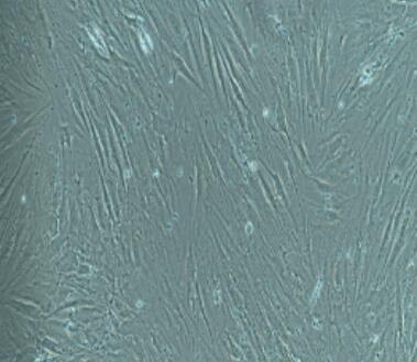 大鼠甲状腺成纤维细胞