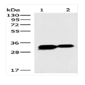 Anti-HCCS兔多克隆抗体