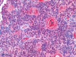 鼠抗人c-myc抗体