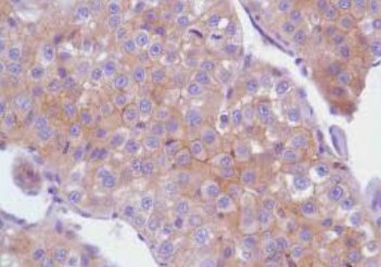 Rabbit Anti-Human EGF Receptor (EGFR)