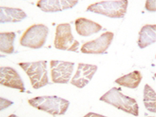 兔抗AKT多克隆抗体