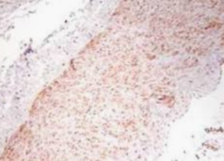 辣根过氧化物酶标记 肿瘤坏死因子抗体