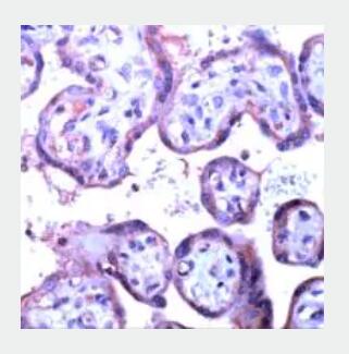 Anti-VEGF-C Polyclonal Antibody