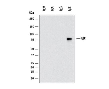 Mouse Anti-Human IgE Antibody