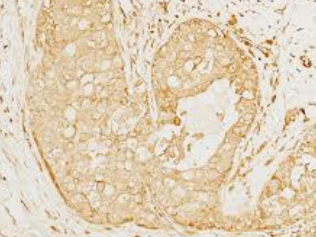 ANTI-IL-12 P70抗体