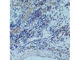 ANTI-HISTONE H3 (PHOSPHO T118)抗体