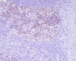 磷酸化组蛋白H3抗体(T3)