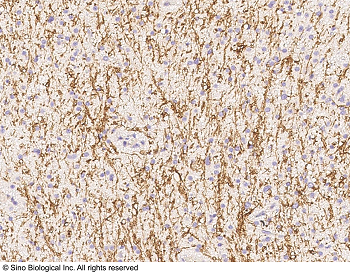 CHAT胆碱乙酰转移酶抗体