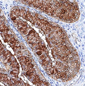 辣根过氧化物酶标记羊抗大鼠IGG