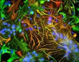 ANTI-GFAP POLYCLONAL ANTIBODY