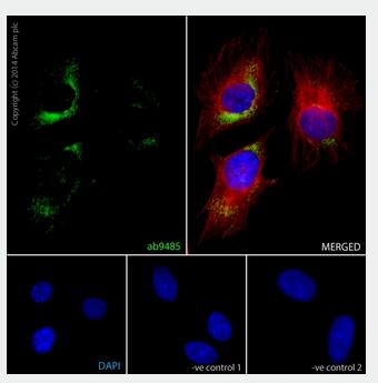 兔抗GAPDH多克隆抗体