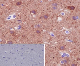 ANTI-BETA II TUBULIN抗体