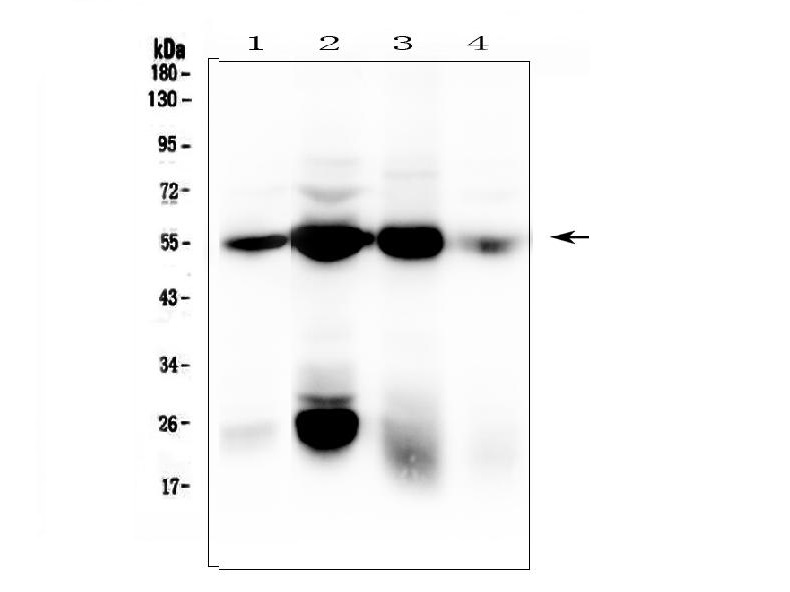 MOUSE ANTI HUMAN VIMENTIN 抗体
