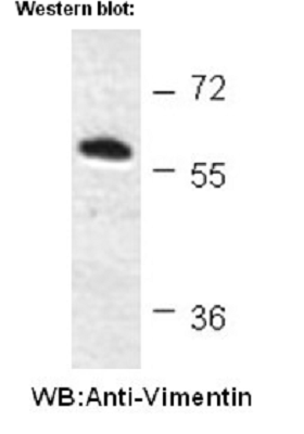 抗波形蛋白小鼠单克隆抗体