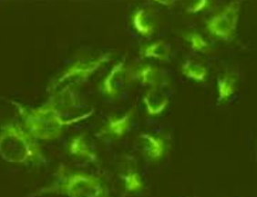 抗波形蛋白小鼠单克隆抗体