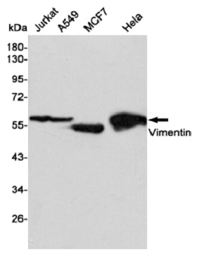 抗波形蛋白小鼠单克隆抗体