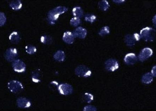 Anti-Bcl-2 (Ab-2) Rabbit pAb