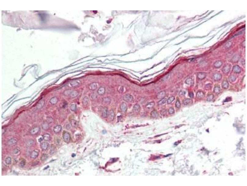 Rabbit Anti-Human TNF-α