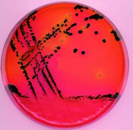 伊红美蓝培养基（EMB）