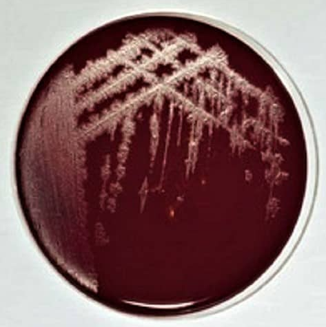 破伤风梭菌培养基基础