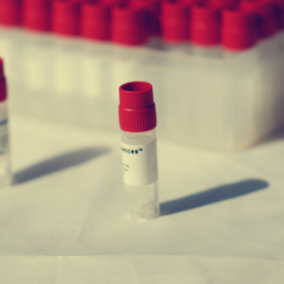 空白比格犬血浆