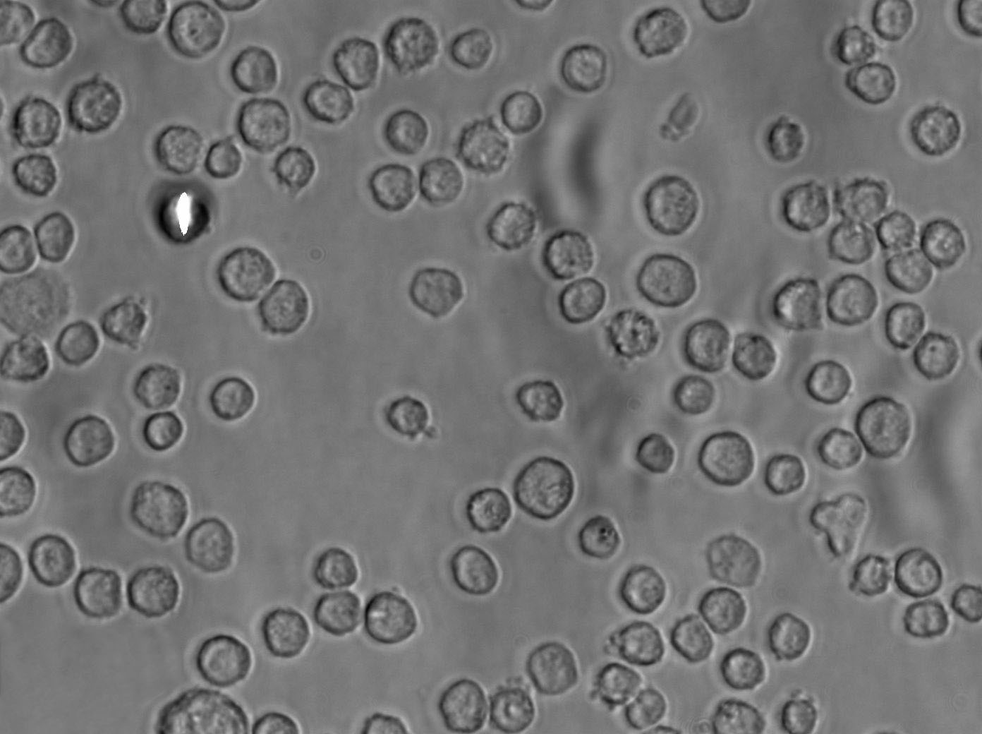 EL4 Cell|EL4小鼠淋巴瘤细胞