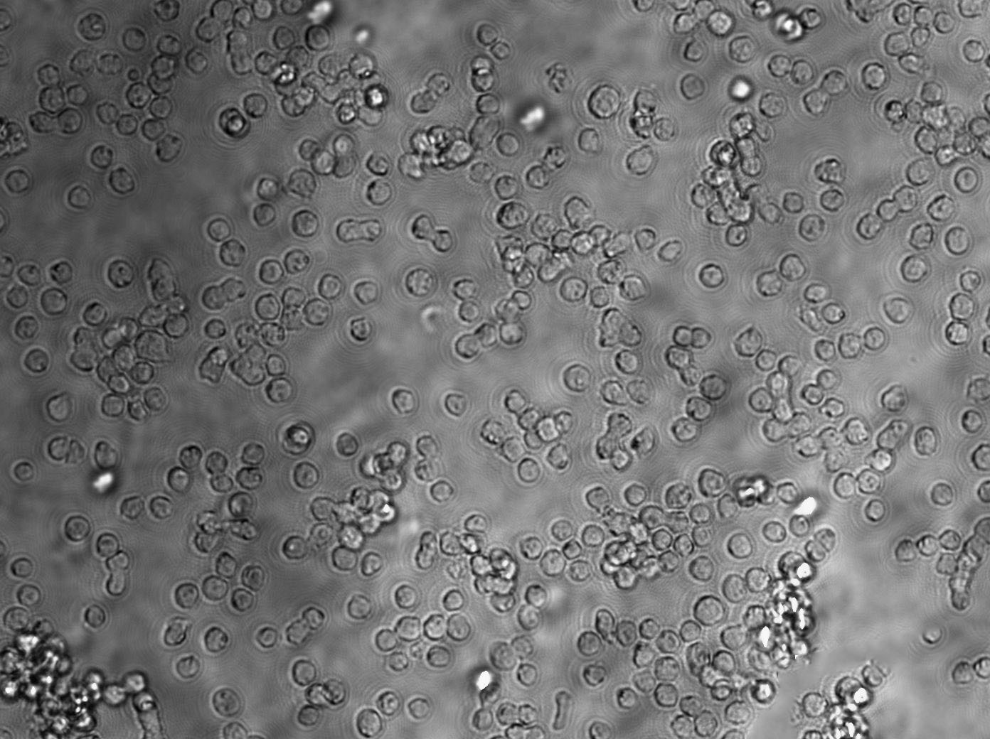 JVM-2 Cell|EB病毒感染的人外周淋巴细胞