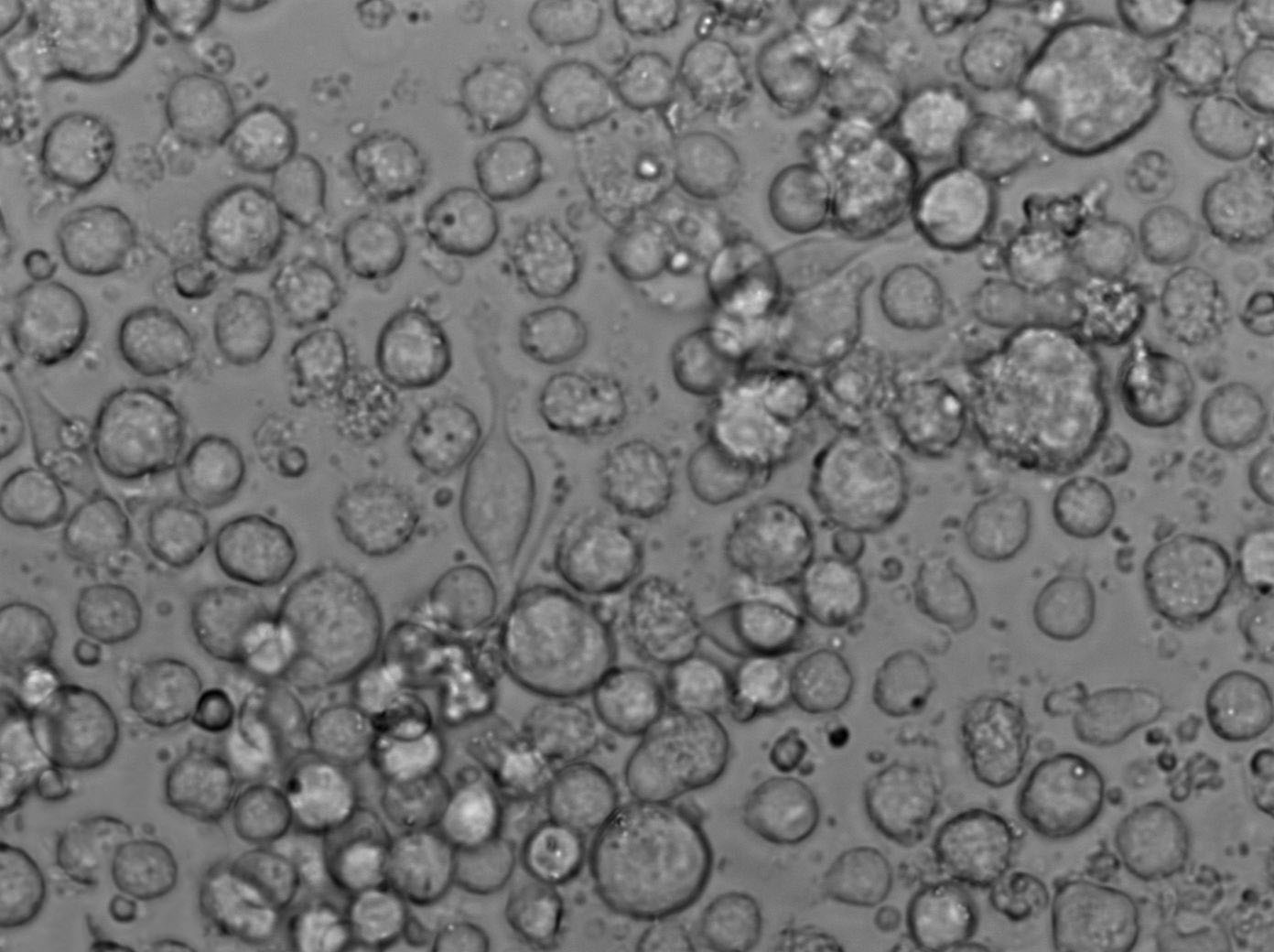 EB1 Cell|人B淋巴细胞瘤细胞