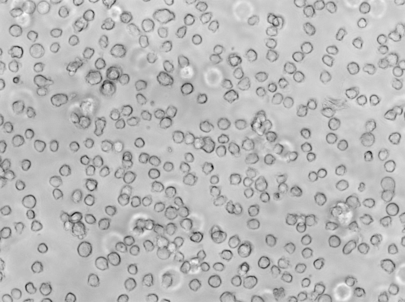 Toledo Cell|人皮肤T淋巴细胞瘤细胞