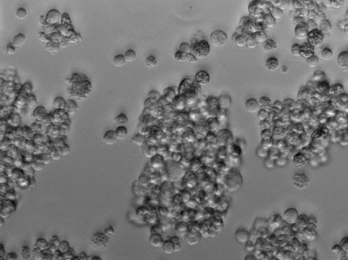 HL-60 Clone 15 Cell|人急性早幼粒细胞白血病细胞
