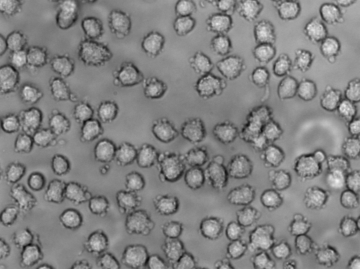 MAVER-1 Cell|人淋巴细胞瘤细胞